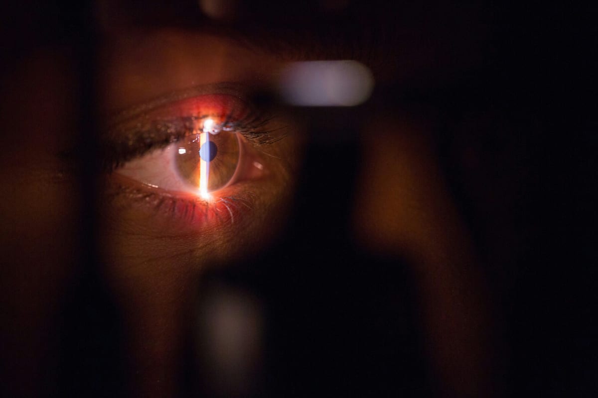 Excimer-Laser im Operationssaal einer Augenklinik, wie er bei einer LASIK-Behandlung eingesetzt wird