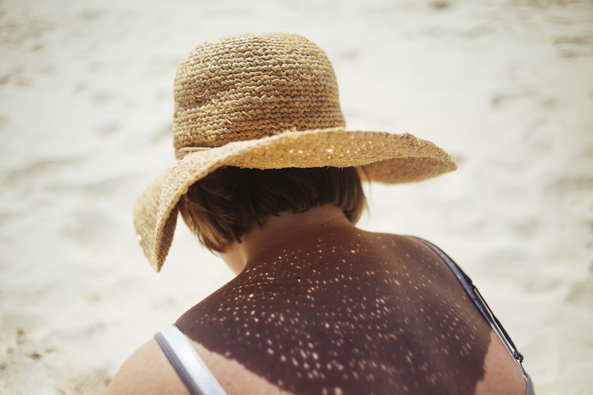 Frau mit Strohhut am Strand, Sonnenlicht auf den ungeschützten Schultern